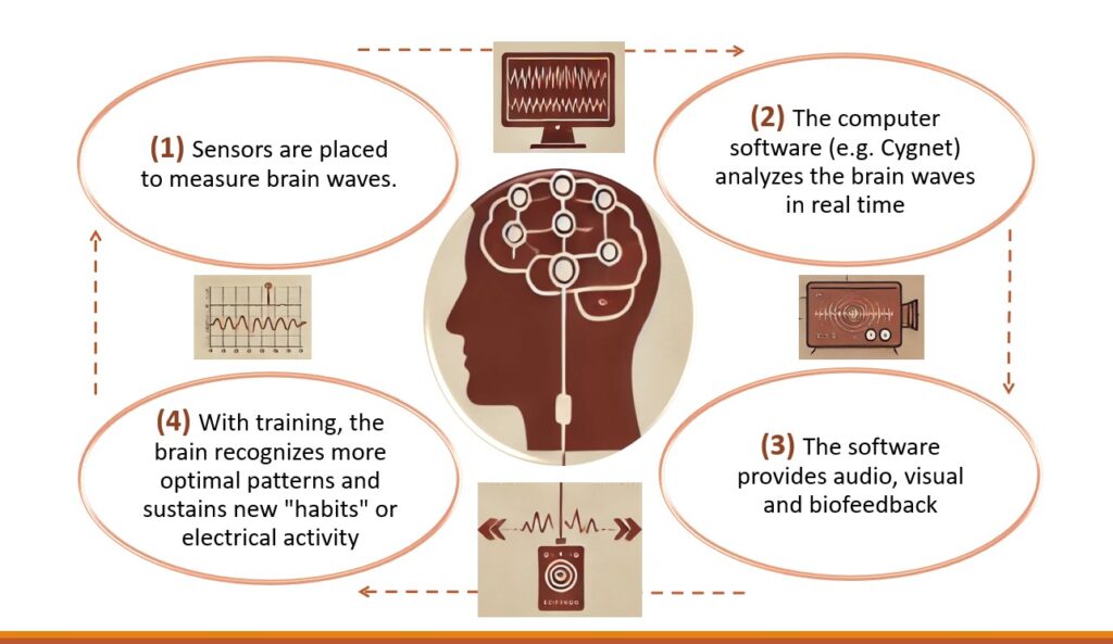 Neurofeedback Neurofeedback
